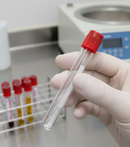 Premium Serum Analysis Tubes with Hemogard Cap - 4 ml Silica Clot Activator Tubes for Enhanced Safety and Compliance