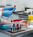 Premium Serum Analysis Tubes with Hemogard Cap - 4 ml Silica Clot Activator Tubes for Enhanced Safety and Compliance